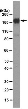 Anti-Endosialin Antibody, clone B1/35 clone B1/35, from mouse