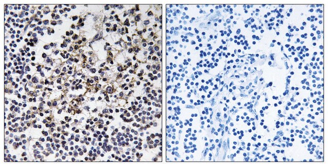 Anti-PGLS antibody produced in rabbit affinity isolated antibody