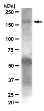 Anti-IRS1-Antikörper, Klon 58-10C-31, Kaninchen, monoklonal clone 58-10C-31, from rabbit