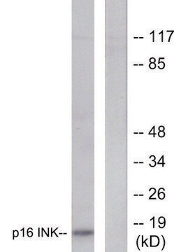 抗 p16 油墨 兔抗 affinity isolated antibody