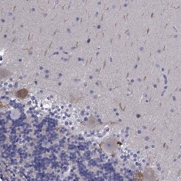 Anti-PLXNA4 antibody produced in rabbit Prestige Antibodies&#174; Powered by Atlas Antibodies, affinity isolated antibody, buffered aqueous glycerol solution