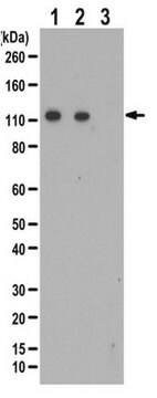 抗磷酸化ULK1 抗体（Ser777） from rabbit, purified by affinity chromatography