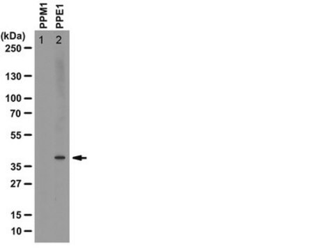 该抗甲基PP2A抗体（C亚基，克隆2A10） clone 2A10, from mouse