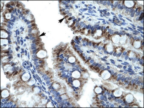 Anti-KRT15 antibody produced in rabbit affinity isolated antibody