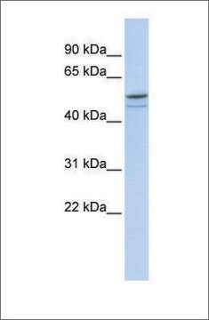 抗DMRTA1抗体 ウサギ宿主抗体 affinity isolated antibody