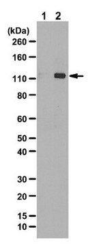 Anticorps anti-phospho-ULK1 (Ser555) from rabbit, purified by affinity chromatography