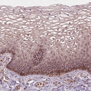 Anti-NFAT5 antibody produced in rabbit Prestige Antibodies&#174; Powered by Atlas Antibodies, affinity isolated antibody, buffered aqueous glycerol solution