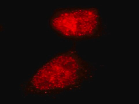 LentiBrite RFP-Rad51 Lentiviral Biosensor