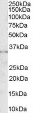 抗CD32/FCGR2B抗体 ヤギ宿主抗体 affinity isolated antibody, buffered aqueous solution