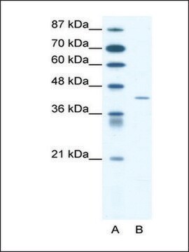 Anti-SSTR4 antibody produced in rabbit affinity isolated antibody