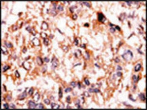 Anti-ADCK1 (N-term) antibody produced in rabbit IgG fraction of antiserum, buffered aqueous solution