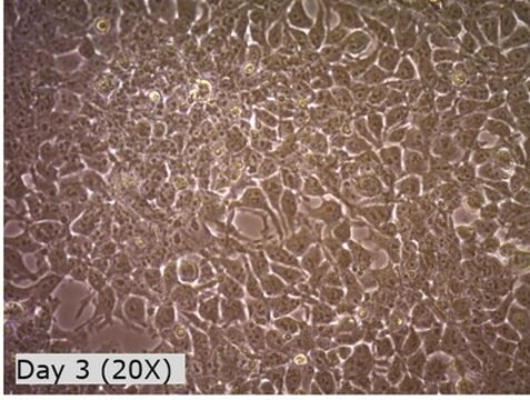 Ligne cellulaire&nbsp;293T exprimant la R-Spondin1 The R-Spondin1-Expressing 293T cell line produces RSPO1, a critical protein used to establish 3D organoid cultures from stomach, small intestine, colon, pancreas, and liver sources.