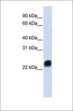 Anti-HMGB1 affinity isolated antibody