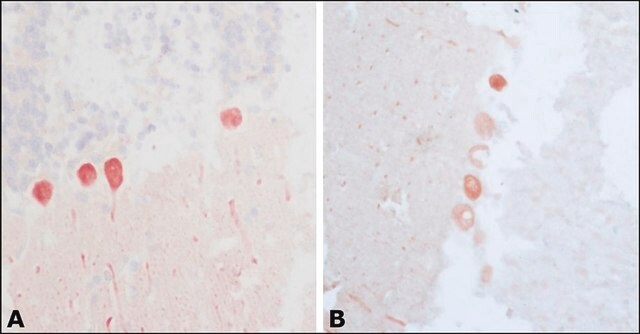 抗カルビンジン-D-28K (KD-15) ウサギ宿主抗体 affinity isolated antibody, buffered aqueous solution