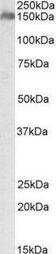 Anti-CSMD1 antibody produced in goat affinity isolated antibody, buffered aqueous solution