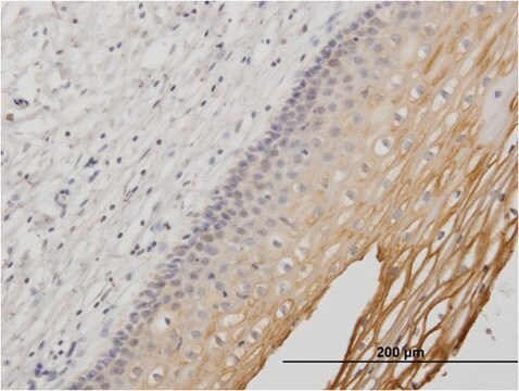 モノクローナル抗MUC1抗体 マウス宿主抗体 clone 1B7, purified immunoglobulin, buffered aqueous solution