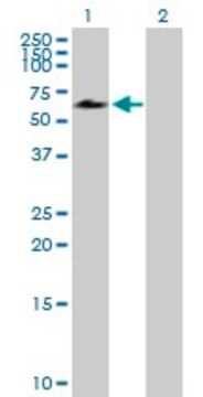 Anti-ACD antibody produced in mouse purified immunoglobulin, buffered aqueous solution