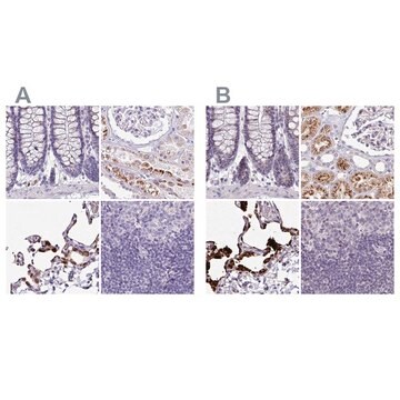 Anti-NAPSA antibody produced in rabbit Prestige Antibodies&#174; Powered by Atlas Antibodies, affinity isolated antibody, buffered aqueous glycerol solution