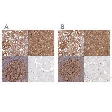 Anti-LAP3 antibody produced in rabbit Prestige Antibodies&#174; Powered by Atlas Antibodies, affinity isolated antibody, buffered aqueous glycerol solution, ab2