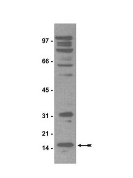 Anticorps anti-diméthyl-arginine symétrique (SYM11) Upstate&#174;, from rabbit