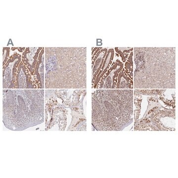 抗MAVS抗体 ウサギ宿主抗体 Prestige Antibodies&#174; Powered by Atlas Antibodies, affinity isolated antibody, buffered aqueous glycerol solution