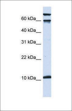 Anti-GAL antibody produced in rabbit affinity isolated antibody