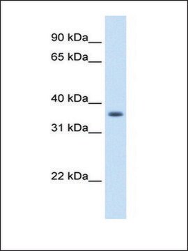 Anti-AKR1B10 antibody produced in rabbit IgG fraction of antiserum