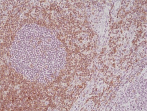 Anti-CD5 antibody, Rabbit monoclonal recombinant, expressed in HEK 293 cells, clone RM354, purified immunoglobulin