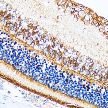 Anti-CRALBP antibody produced in rabbit