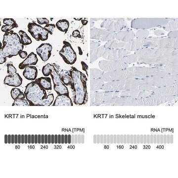 抗KRT7 ウサギ宿主抗体 Prestige Antibodies&#174; Powered by Atlas Antibodies, affinity isolated antibody, buffered aqueous glycerol solution