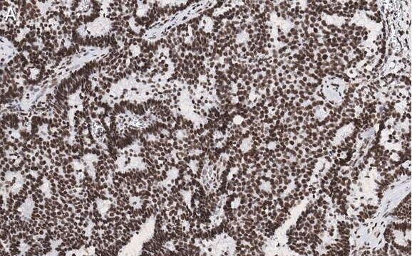 Anti-p-ATM (Ser1981) Antibody, clone 1E19, ZooMAb&#174; Rabbit Monoclonal recombinant, expressed in HEK 293 cells