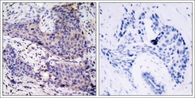 Anti-BAD (Ab-136) antibody produced in rabbit affinity isolated antibody