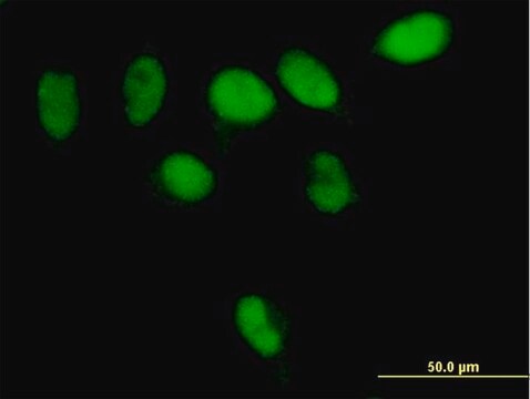 Anti-PARG antibody produced in mouse IgG fraction of antiserum, buffered aqueous solution