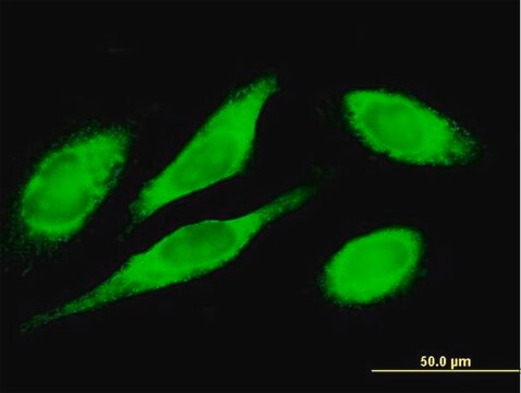 Anti-MTDH antibody produced in mouse purified immunoglobulin, buffered aqueous solution