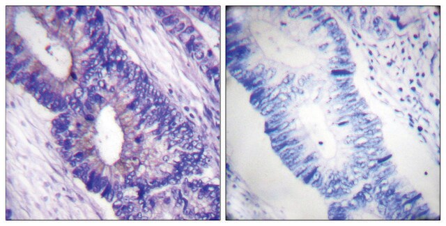 Anty-fosfo-PKAα/β CAT (pThr197) affinity isolated antibody