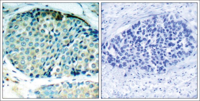 Anti-phospho-HSPB1 (pSer78) antibody produced in rabbit affinity isolated antibody