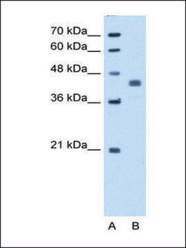 Anti-PDHA1 (AB1) antibody produced in rabbit IgG fraction of antiserum