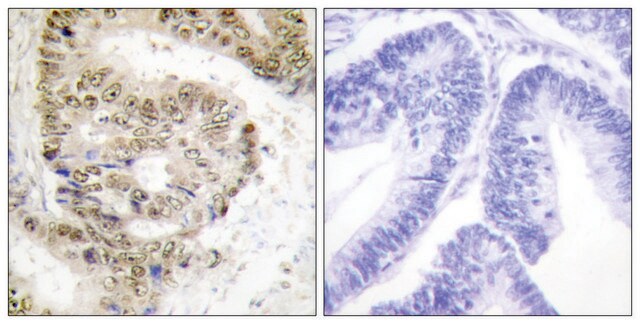 Anti-HNRNP L antibody produced in rabbit affinity isolated antibody