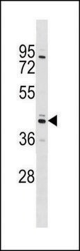 ANTI-SHBG (N-TERM) antibody produced in rabbit IgG fraction of antiserum, buffered aqueous solution