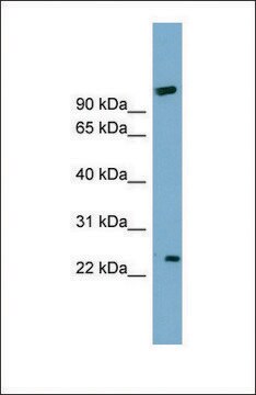 Anti-ARL8B antibody produced in rabbit affinity isolated antibody