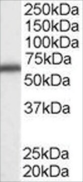 抗DDX5/P68 RNAヘリカーゼ抗体 ヤギ宿主抗体 affinity isolated antibody, buffered aqueous solution