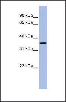 Anti-PPM1A antibody produced in rabbit affinity isolated antibody