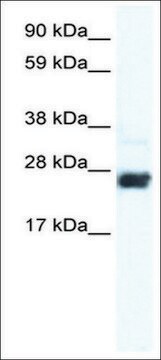 Anti-CDX2 antibody produced in rabbit affinity isolated antibody