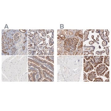 抗CD2AP ウサギ宿主抗体 Ab1, Prestige Antibodies&#174; Powered by Atlas Antibodies, affinity isolated antibody, buffered aqueous glycerol solution