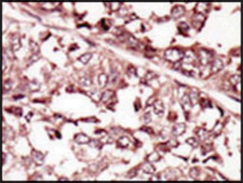 抗-ROS（N端） 兔抗 IgG fraction of antiserum, buffered aqueous solution