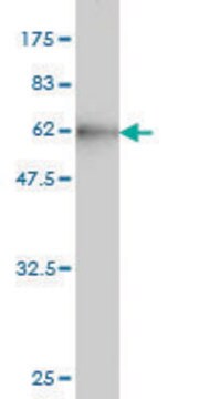 Monoclonal Anti-CBR1 antibody produced in mouse clone 4D12-1G8, purified immunoglobulin, buffered aqueous solution