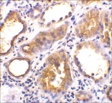 抗-ACE2 兔抗 affinity isolated antibody, buffered aqueous solution