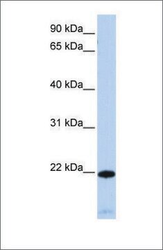 Anti-RGS5 antibody produced in rabbit affinity isolated antibody