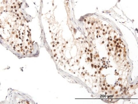 抗RAD51抗体 マウス宿主抗体 purified immunoglobulin, buffered aqueous solution