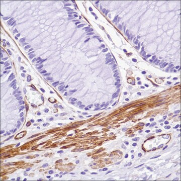 Anti-Caldesmon-Pan antibody, Rabbit monoclonal recombinant, expressed in proprietary host, clone SP226, affinity isolated antibody